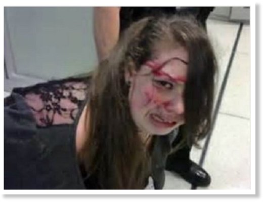 teen beaten by cops